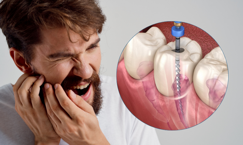 Tooth-With-Root-Canal-Hurt-With-Pressure-drrajudentalcare
