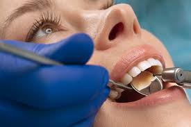 How to Choose the Right Dentist in Akshayanagar | Expert Guide